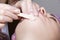 Depilation with hot wax mustache in the beauty salon. Young woman receiving facial epilation close up.