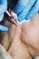 Dermatologist cosmetologist applies cosmetic injection of botulinum toxin