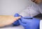 A dermatologist examines a toenail affected by a fungus. Treatment of mycosis and assistance to patients with fungal diseases