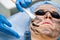 Dermatologist smears black mask on face for laser photorejuvenation and carbon peeling. Dermatology and cosmetology