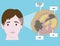 Dermoid cysts symptoms on young patient face. Illustration