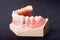 Detail dental wax model