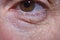 Detail of eye bags and wrinkles of a middle-aged woman