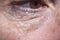 Detail of eye bags and wrinkles of a middle-aged woman