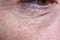 Detail of eye bags and wrinkles of a middle-aged woman