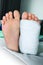 Detail feet - left leg or foot in white plaster.