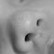 Detail of the nose of a newborn with little cysts