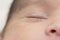 Detail shot of closed eye of a newborn baby peacefully slept at bed