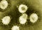 Detail of ultraestructure of deadly coronavirus particles under transmission electron microscopy TEM