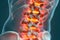 Detailed 3D anatomy illustration of an inflamed lumbar spine with inflammation affecting vertebrae