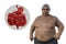 A detailed 3D medical illustration of a senior overweight man and close-up view of his digestive system