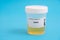 DHEA. DHEA toxicology screen urine tests for doping and drugs