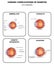 Diabetic Eye Diseases diagram