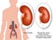 Diabetic nephropathy