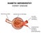 Diabetic Nephropathy, glomerulus anatomy