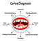 Diagnosis of caries. Bad breath. Halitosis. The structure of the teeth and oral cavity with caries. Diseases of the