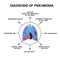 Diagnosis of pneumonia. Human respiratory organs. World Pneumonia Day. The anatomical structure of inflamed lungs