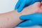 Diagnosis of skin diseases - allergies, psoriasis, eczema, dermatitis. A dermatologist with gloves examines the skin of a sick