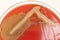 Diagnostic bacterial culture on red agar