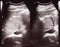 Diagnostic sonography of abdomen