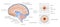 Diagram Illustrating Cerebrospinal Fluid CSF in the Brain Central Nervous System. Brain structure,2d graphic