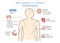 Diagram of main symptoms of infectious Pneumonia.