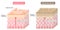 Diagram of skin cell turnover and thickening of the stratum corneum. Skin care and beauty concept