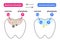 Diagram of tooth demineralization and remineralization. Dental care concept