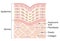 Diagram of winkle skin. the collagen framework is broken and wrinkles appears. Beauty skin care concept