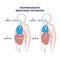 Diaphragmatic breathing technique with inhale and exhale outline diagram