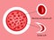 Difference of normal red blood cells and sickle cells