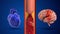 Difference between stroke and heart attack