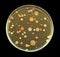 Different bacterial colonies on petri dish isolated on black background