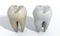 Dirty Clean Tooth Comparison