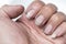 Dirty finger nails unhealthy pile up germ and bacteria unclean