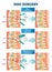 Disc surgery vector illustration. Diagram with back nerves and bones pain.