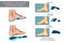 Diseases of the foot. Foot orthotics in the treatment of lower limb conditions