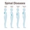 Diseases of the spine. Lordosis, kyphosis, flat-back and sway-back