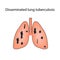 Disseminated tuberculosis. Vector illustration on isolated background