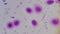 DNA Fragmentation Test in Human spermatozoid Halosperm