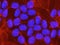 The DNA of human embryonic stem cells stained in blue with fluorescent dye