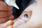 Doctor apply artificial tears gel to senior woman patient eye