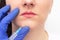 Doctor cosmetologist conducts a procedure to increase the volume of women`s lips with the help of injection of hyaluronic acid
