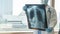 Doctor diagnosing patientâ€™s health on asthma, lung disease, COVID-19 or bone cancer illness with radiological chest x-ray film