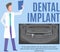 Doctor examines x-ray with healthy teeth and dental implant. Radiologist diagnoses human jaw