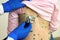 Doctor examining a child with stethoscope covered with green rashes on back ill with chickenpox, measles or rubella virus