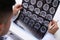 Doctor examining MRI images of patient with multiple sclerosis at white table, closeup