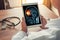 Doctor holding a digital tablet with x-ray of brain and skull skeleton. Headache, meningitis and migraine concept