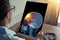 Doctor holding a x-ray of skull head with pain in the front of the brain in medical office. Headache migraine or trauma concept