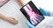 Doctor holds tablet with x-ray of patient hand slow motion 4k movie